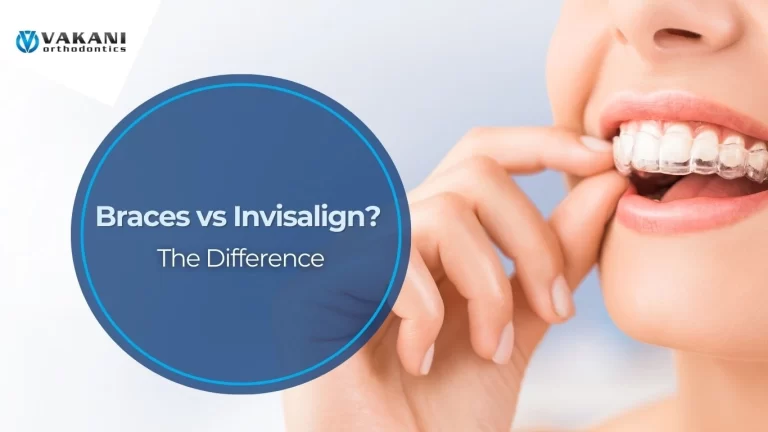 Braces vs Invisalign in Vero Beach, Fort Pierce, FL, Stuart, FL, Palm Bay, FL