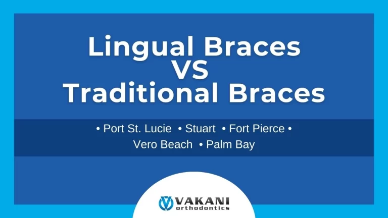 Lingual Braces vs. Traditional Braces in Vero Beach, Fort Pierce, Stuart, and Palm Bay, FL