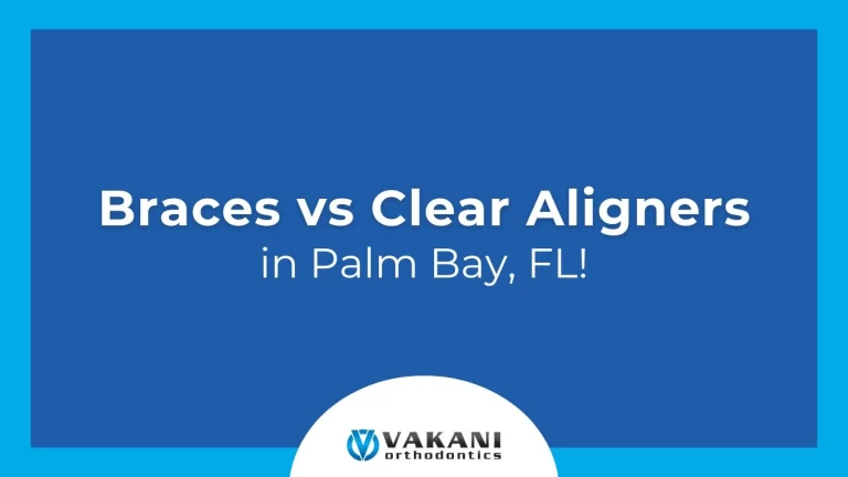 Braces vs. Clear Aligners in Palm Bay