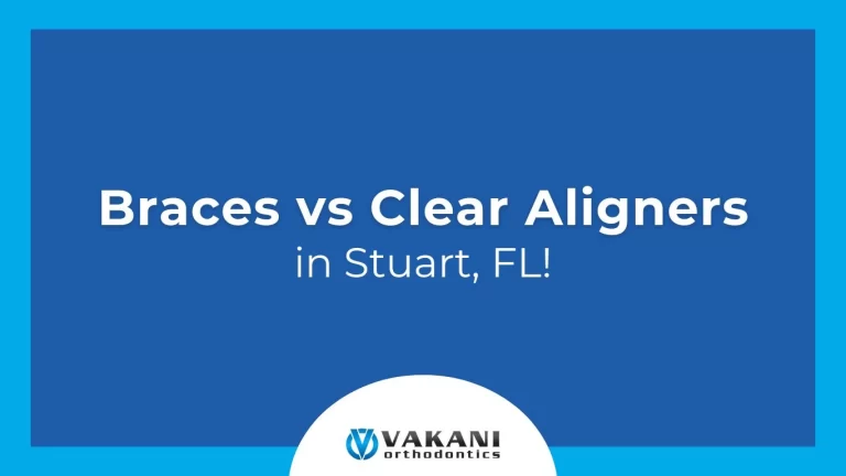 Braces vs Clear Aligners in Stuart