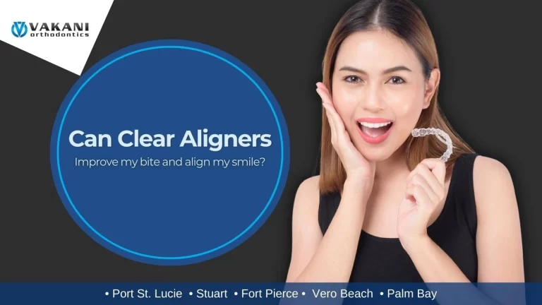 Clear Aligners in Stuart, Port St. Lucie, Vero Beach, Fort Pierce, and Palm Bay, FL