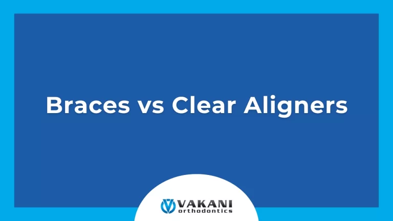 Braces vs Clear Aligners in Vero Beach, Fort Pierce, Stuart, and Palm Bay, FL